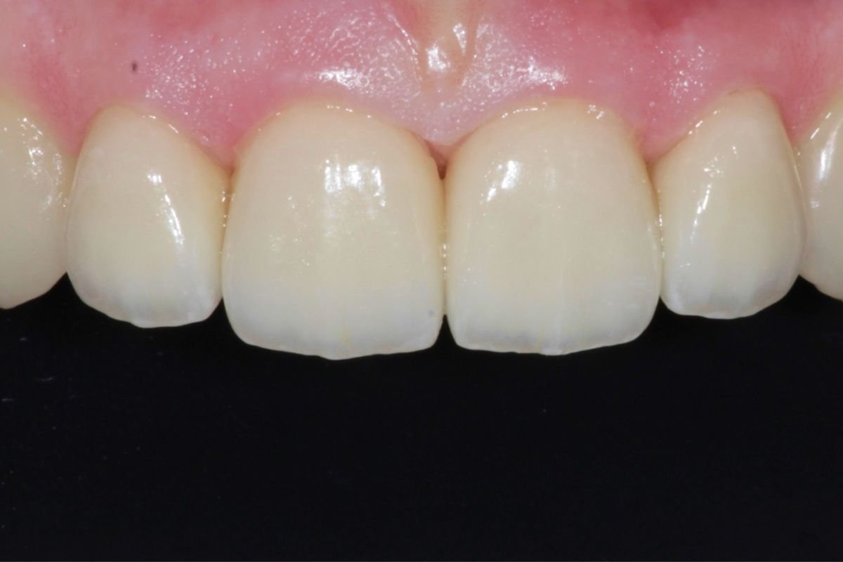 Before image