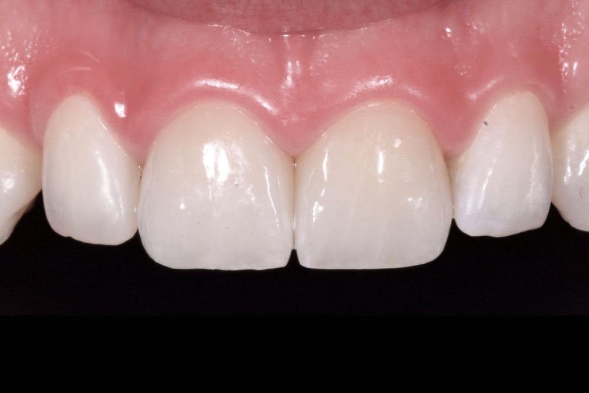 Before image