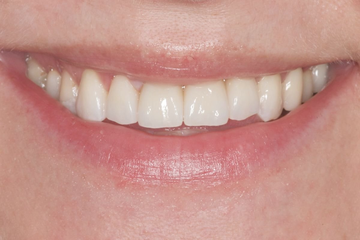 Before image