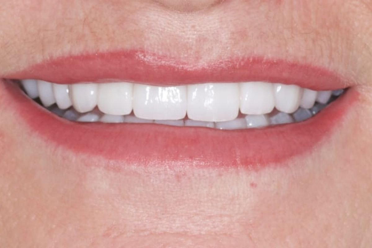 Before image