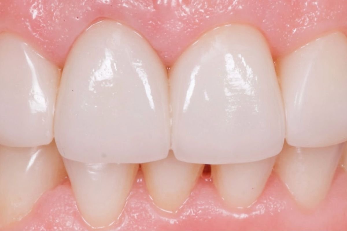 Before image